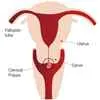 Uterine-or-cervix