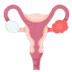 Uterus